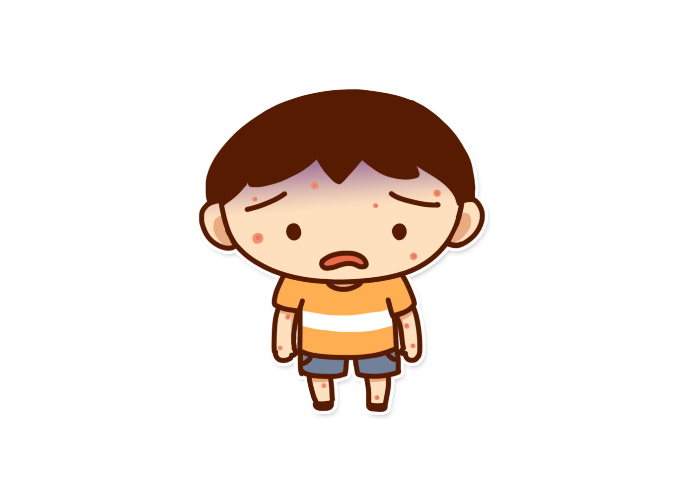 水痘1.jpg